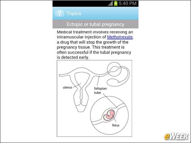 13 - Researching Pregnancy Topics