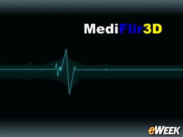 MediFlir3D Takes Thermographic Medical Diagnostics to Third Dimension