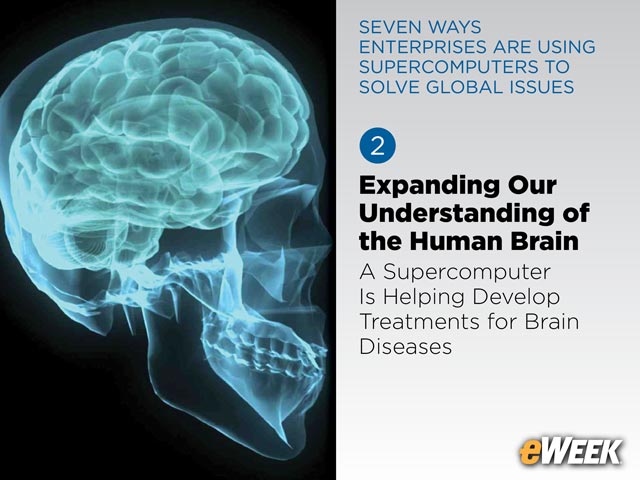 Expanding Our Understanding of the Human Brain